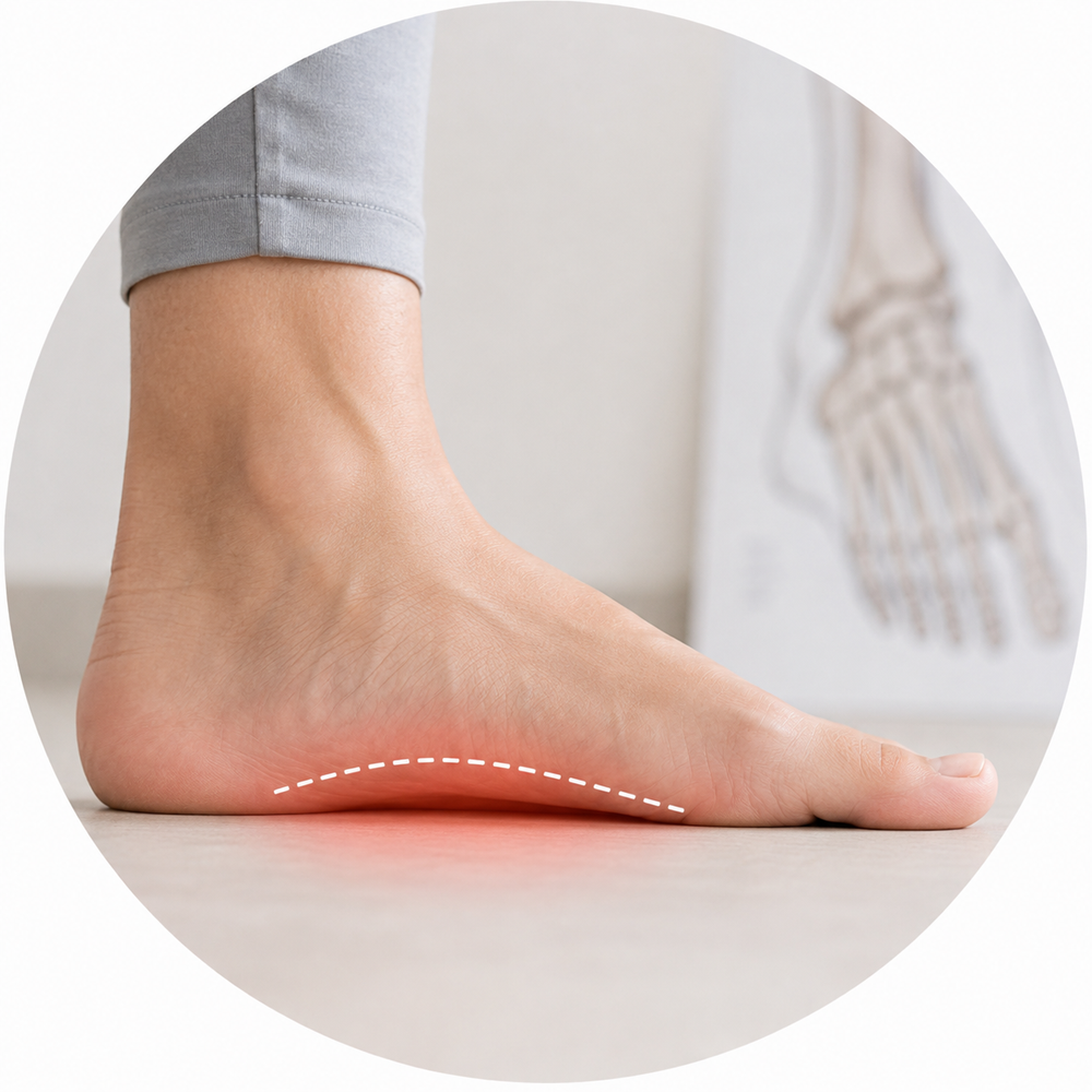 Flat Feet